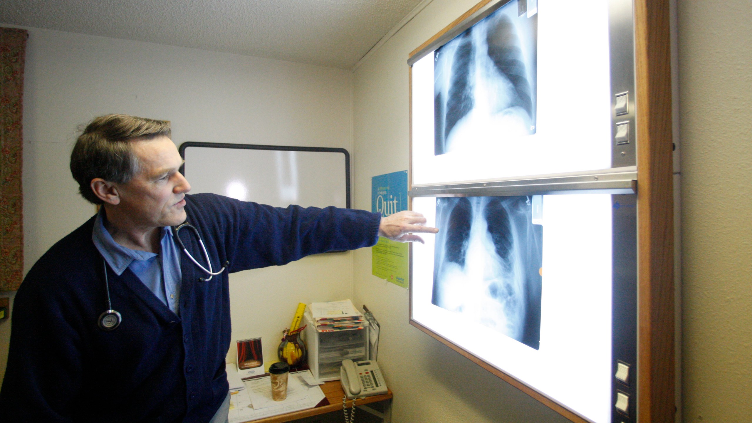 FILE - Dr. Brad Black with the Center for Asbestos Related Disease health clinic is shown looking at X-rays, Feb. 18, 2010, in Libby, Mont. Attorneys for the clinic denied allegations that it submitted false medical claims, earning Libby residents lifetime government medical benefits. (AP Photo/Rick Bowmer, File)