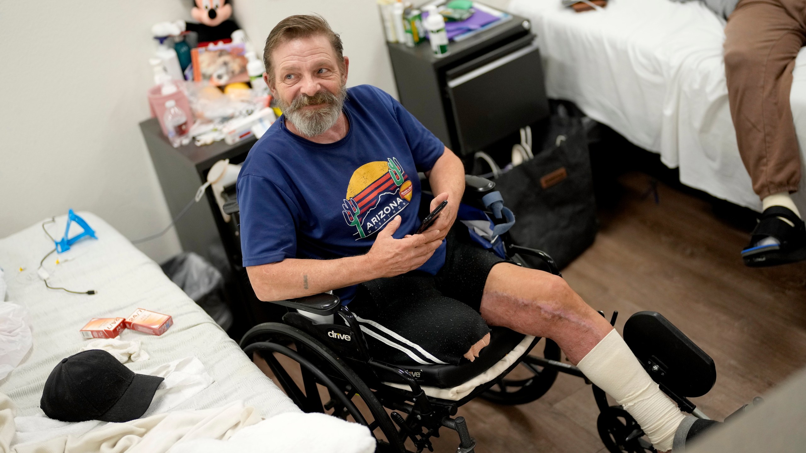 Ron Falk, 62, speaks of losing his leg, Tuesday, June 25, 2024 in Phoenix. Falk lost his right leg, had extensive skin grafting on the left one and is still recovering a year after collapsing on the searing asphalt outside a convenience store where he stopped for a cold soda during a blistering heat wave. (AP Photo/Matt York)