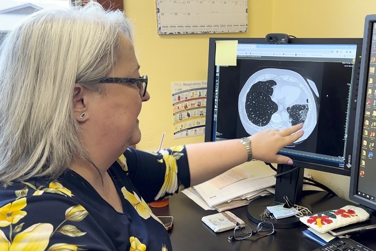 FILE - Dr. Lee Morissette shows an image of lungs damaged by asbestos exposure, April 4, 2024, at the Center for Asbestos Related Disease in Libby, Mont. (AP Photo/Matthew Brown, File)