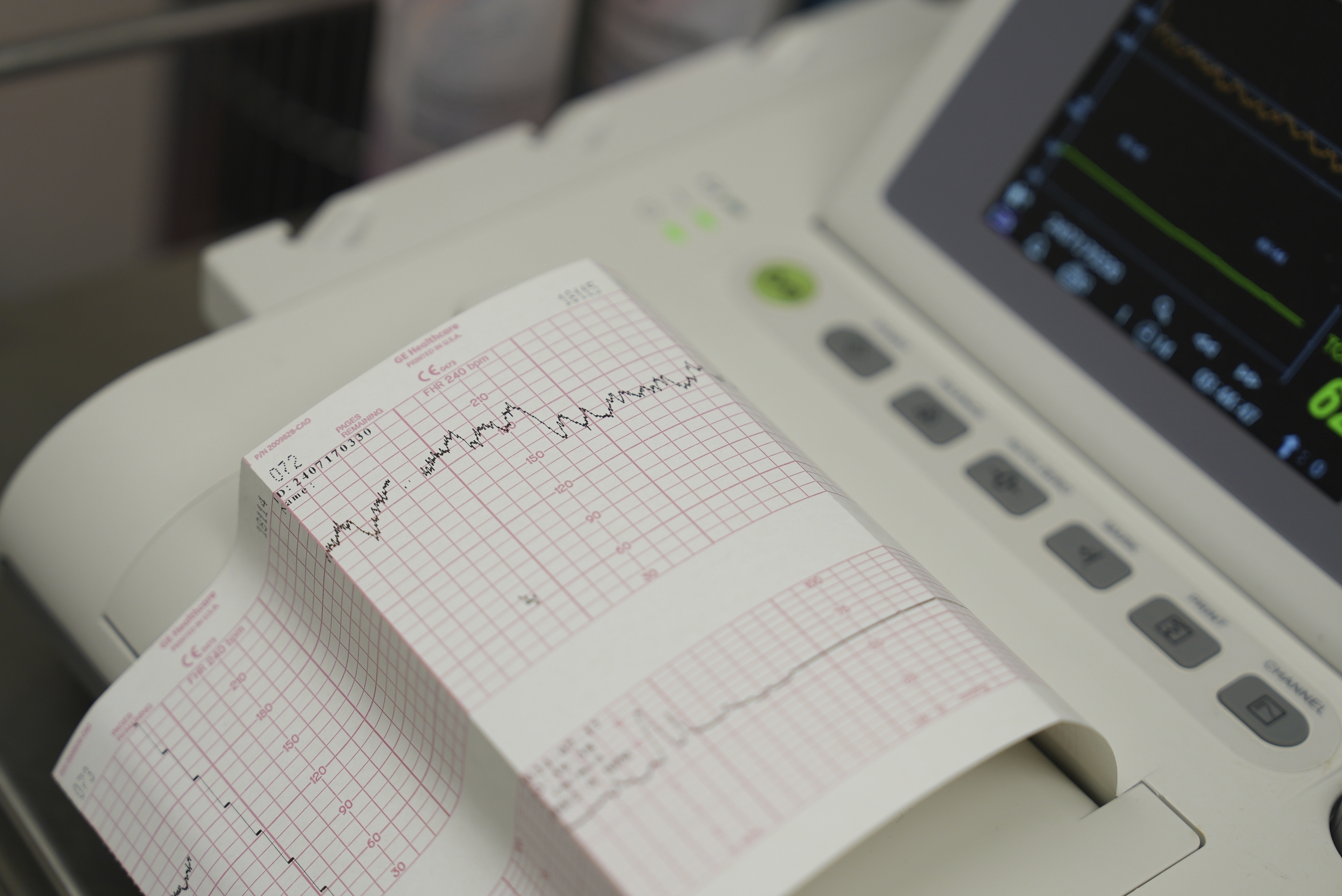 A cardiotocograph measures Denise Jones' contractions and her baby's heart rate during a prenatal appointment at the Oklahoma State University obstetrics and gynecology clinic in Tulsa, Okla., on Tuesday, July 16, 2024. (AP Photo/Mary Conlon)