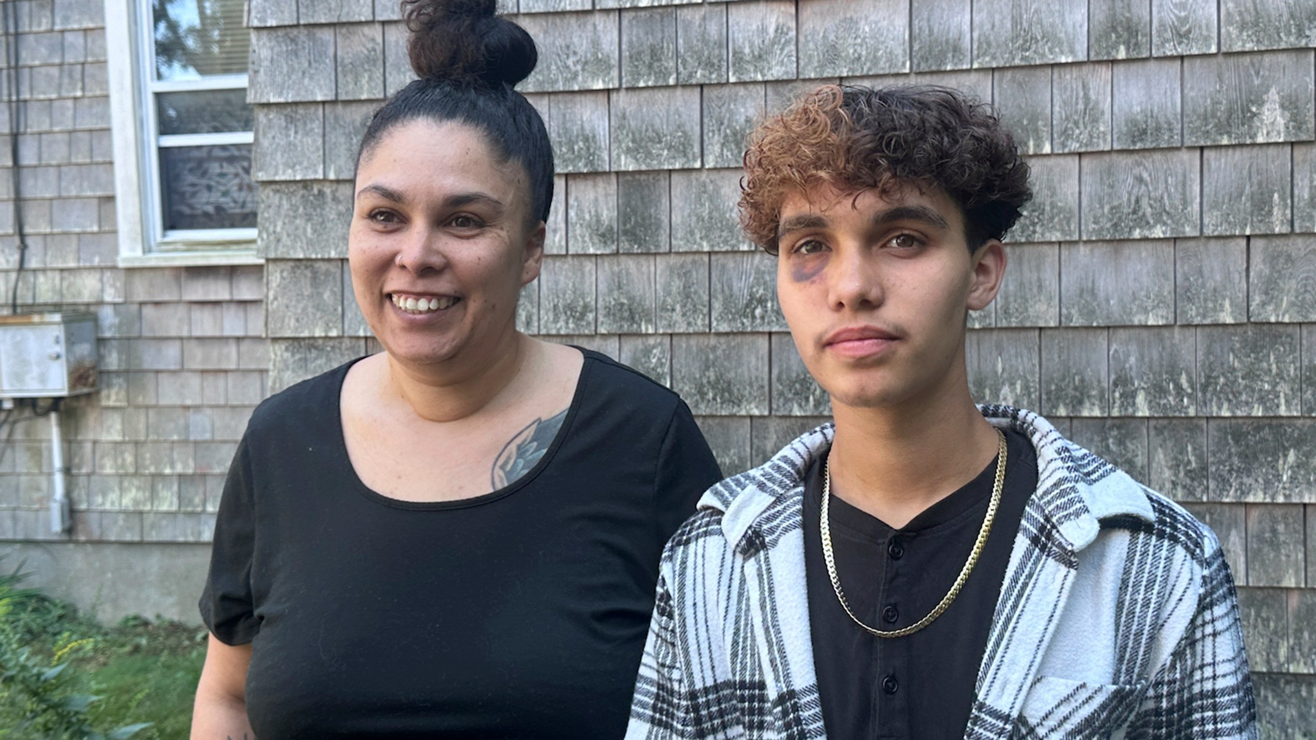 In a photo taken Sept. 4, 2024, in Gloucester, Massachusetts, transgender teenager Jayden Tkaczyk stands outside his house with his mother, Jasmine Tkaczyk. Jayden Tkaczyk alleges that he was beaten up at a party by several other high school students due his being transgender. (AP Photo/Michael Casey)