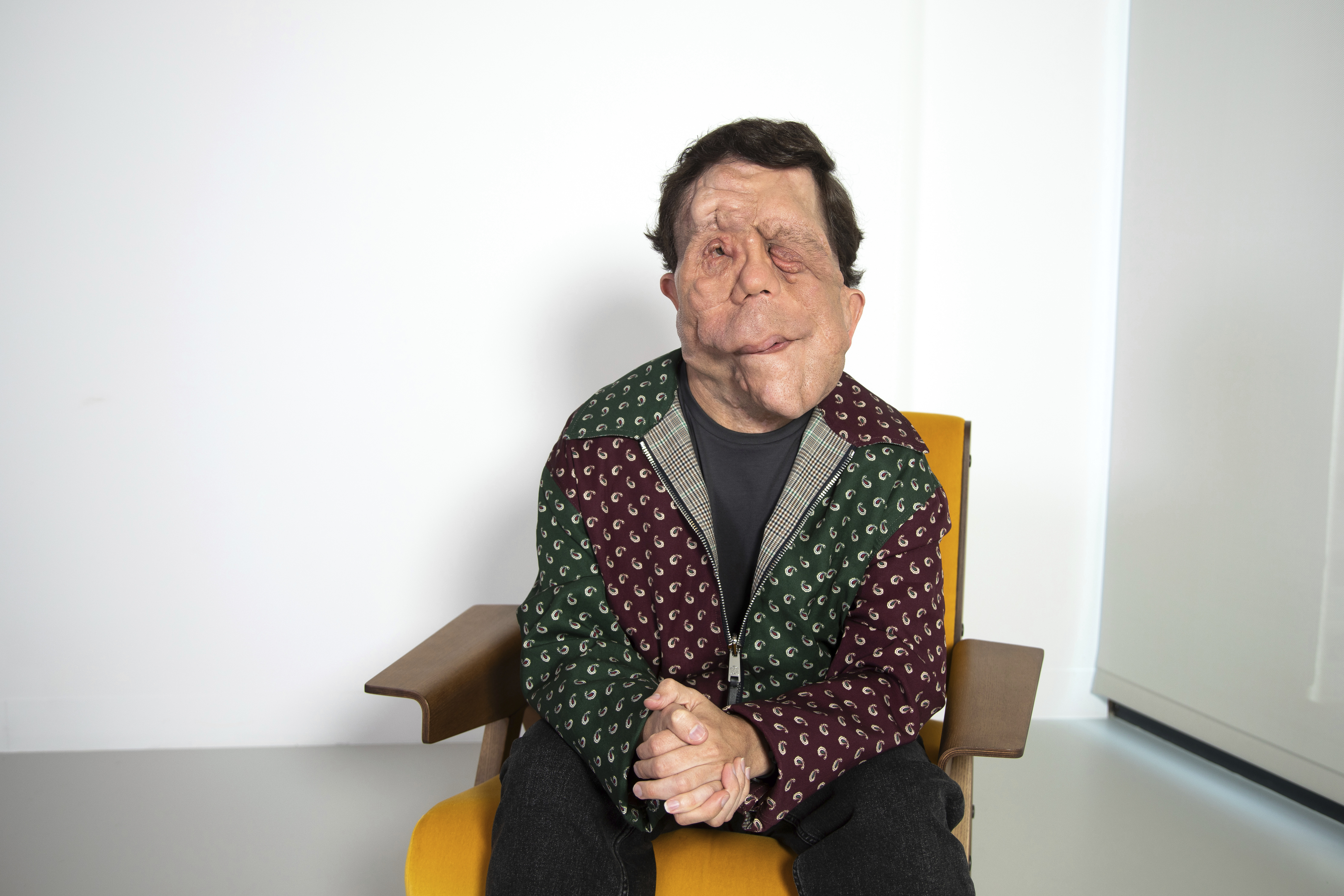 Adam Pearson poses for a portrait on Tuesday, Sept. 17, 2024, in New York. (Photo by Andy Kropa/Invision/AP)