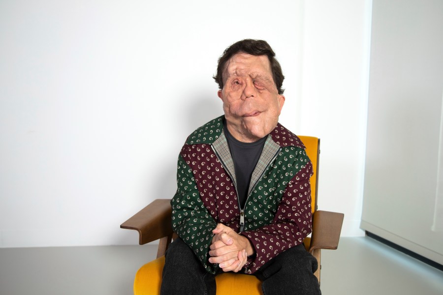 Adam Pearson poses for a portrait on Tuesday, Sept. 17, 2024, in New York. (Photo by Andy Kropa/Invision/AP)