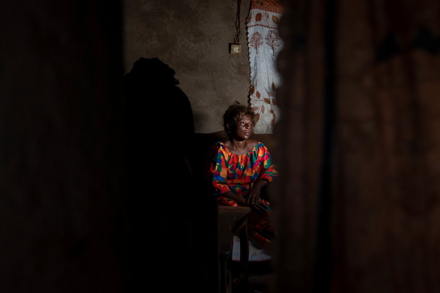 Sifa Kunguja, a 40-year-old sex worker, sits home after recovering from mpox, Wednesday, Sept. 4, 2024, in Kamituga, eastern Congo. (AP Photo/Moses Sawasawa)