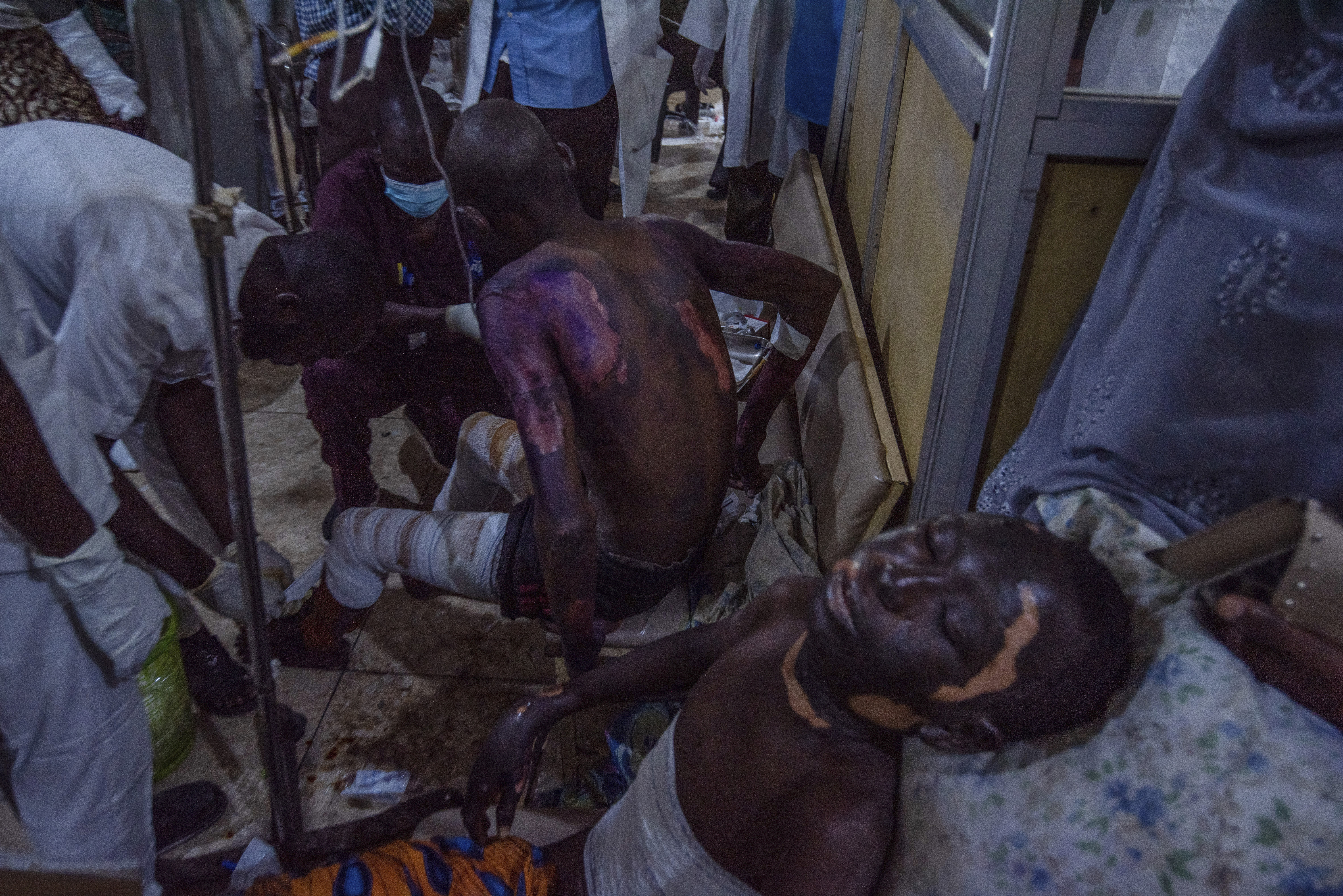 Victims of a tanker explosion from Majiya town receive treatment at the Aminu Kano teaching hospital in Kano Nigeria, Wednesday, Oct. 16, 2024. (AP Photo/Sani Maikatanga)