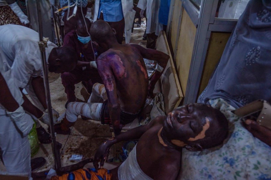 Victims of a tanker explosion from Majiya town receive treatment at the Aminu Kano teaching hospital in Kano Nigeria, Wednesday, Oct. 16, 2024. (AP Photo/Sani Maikatanga)