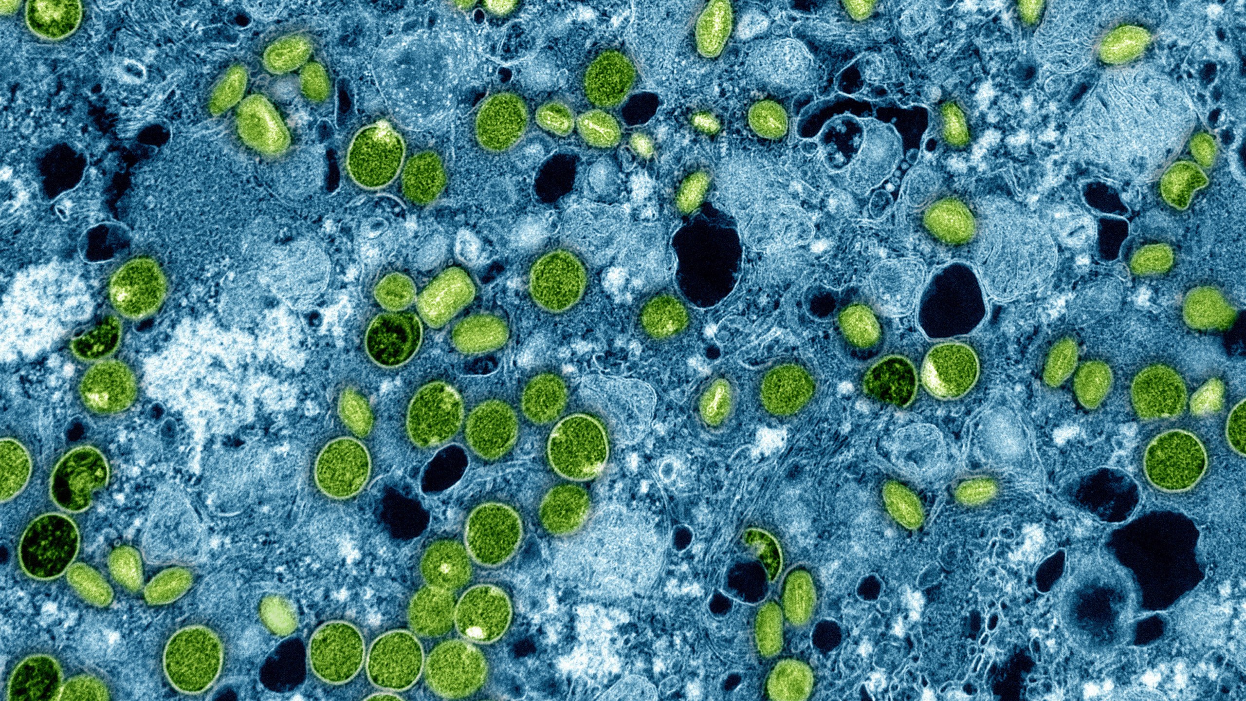 FILE - This colorized electron microscope image provided by the National Institute of Allergy and Infectious Diseases in 2024 shows Mpox virus particles, green, found within infected cultured cells, blue. The virus particles are in various stages of maturity, which accounts for differences in shape. (NIAID via AP, File)