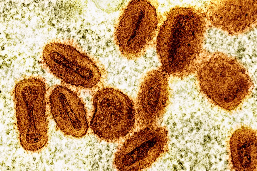 FILE - This colorized electron microscope image provided by the National Institute of Allergy and Infectious Diseases in 2024 shows Mpox virus particles, orange, found within infected cells, green. (NIAID via AP, File)