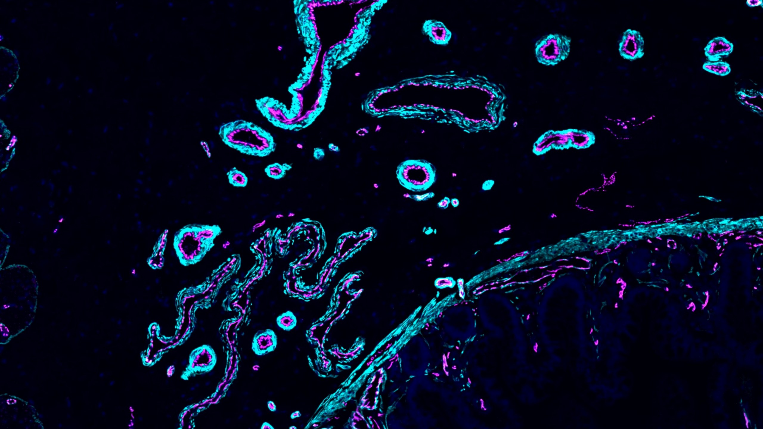 This image provided by Ana-Maria Cujba shows blood vessels in a portion of the human small intestine, March 21, 2024. (Ana-Maria Cujba/Wellcome Sanger Institute via AP)