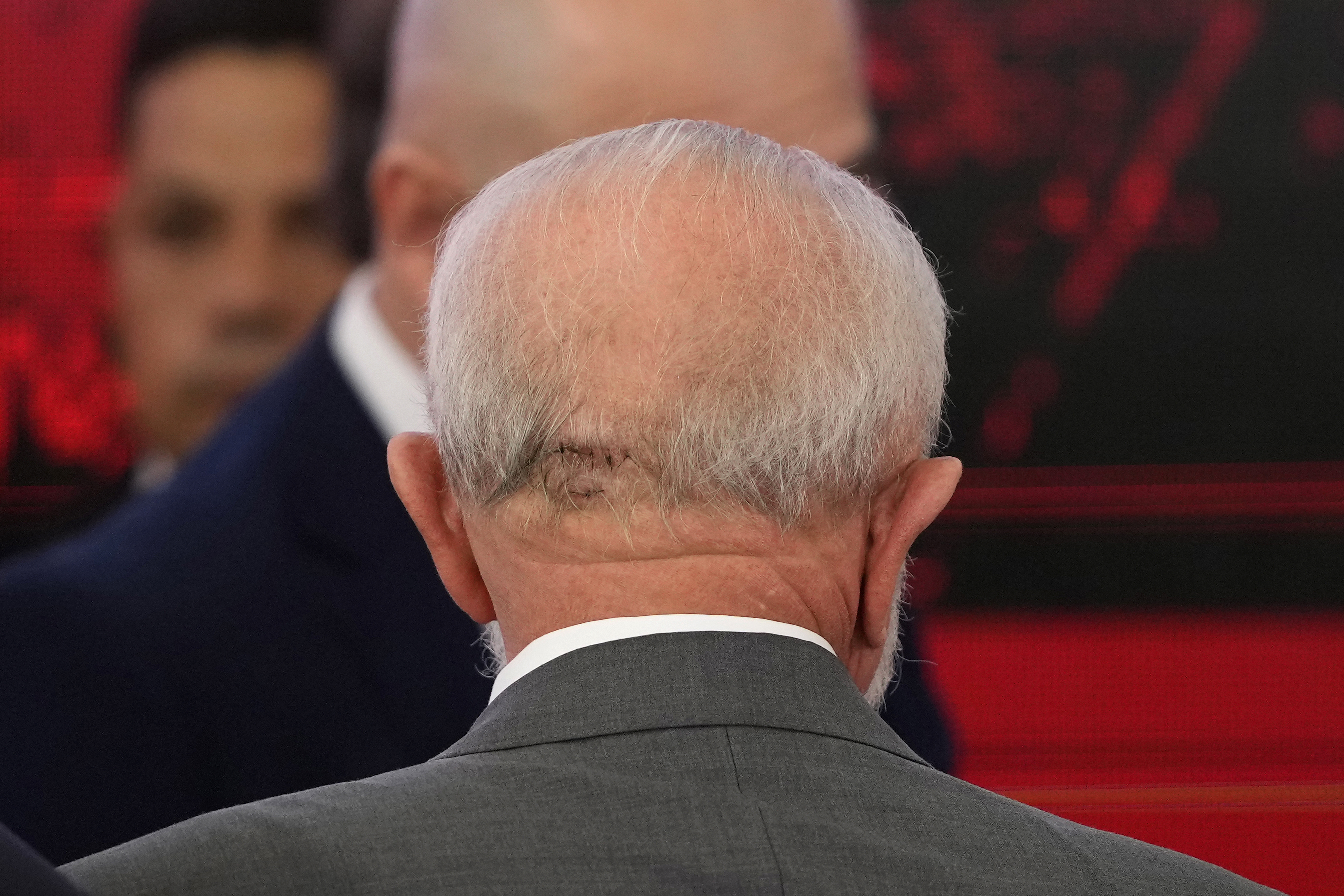 The back of Brazilian President Luiz Inacio Lula da Silva's head shows stitches resulting from a fall, during an event at Planalto Presidential Palace in Brasilia, Brazil, Friday, Oct. 25, 2024. (AP Photo/Eraldo Peres)