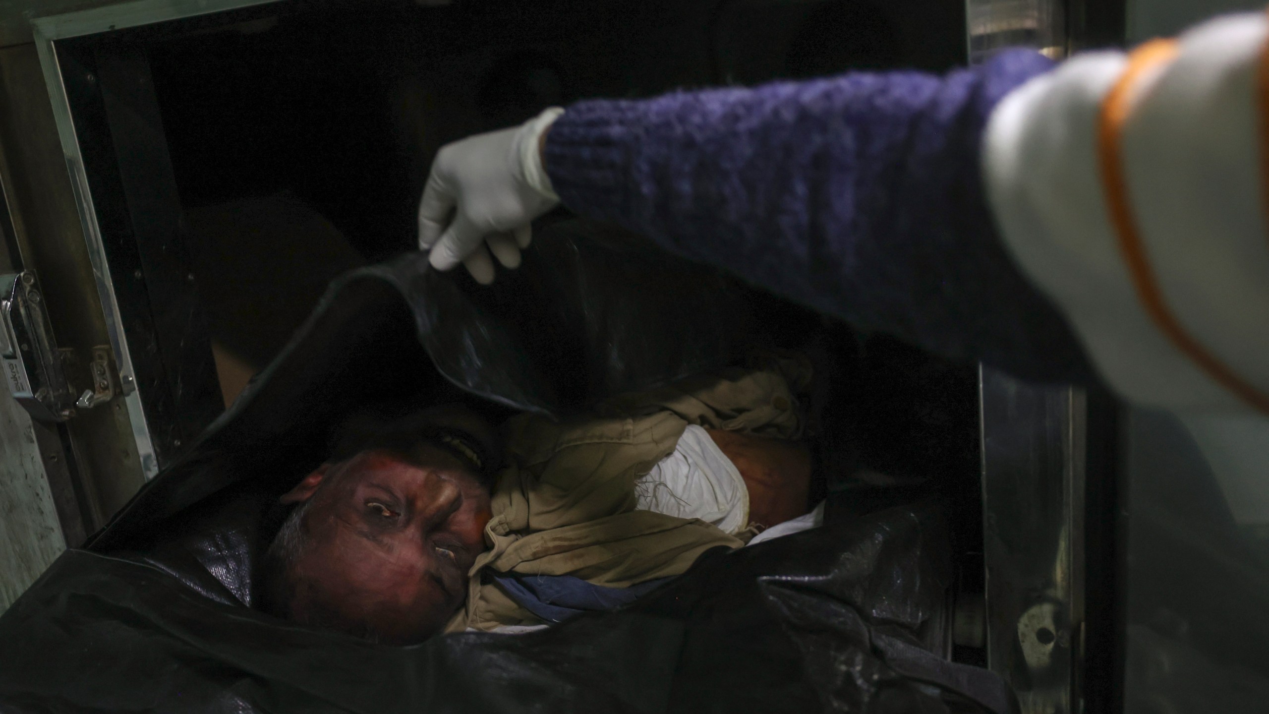 A morgue worker uncovers the body of Syrian activist Mazen al-Hamada before preparing it for burial in Damascus, Thursday, Dec. 12, 2024. Al-Hamad's corpse was found wrapped in a bloody sheet in Saydnaya prison. He had fled to Europe but returned to Syria in 2020 and was imprisoned upon arrival. (AP Photo/Ghaith Alsayed)