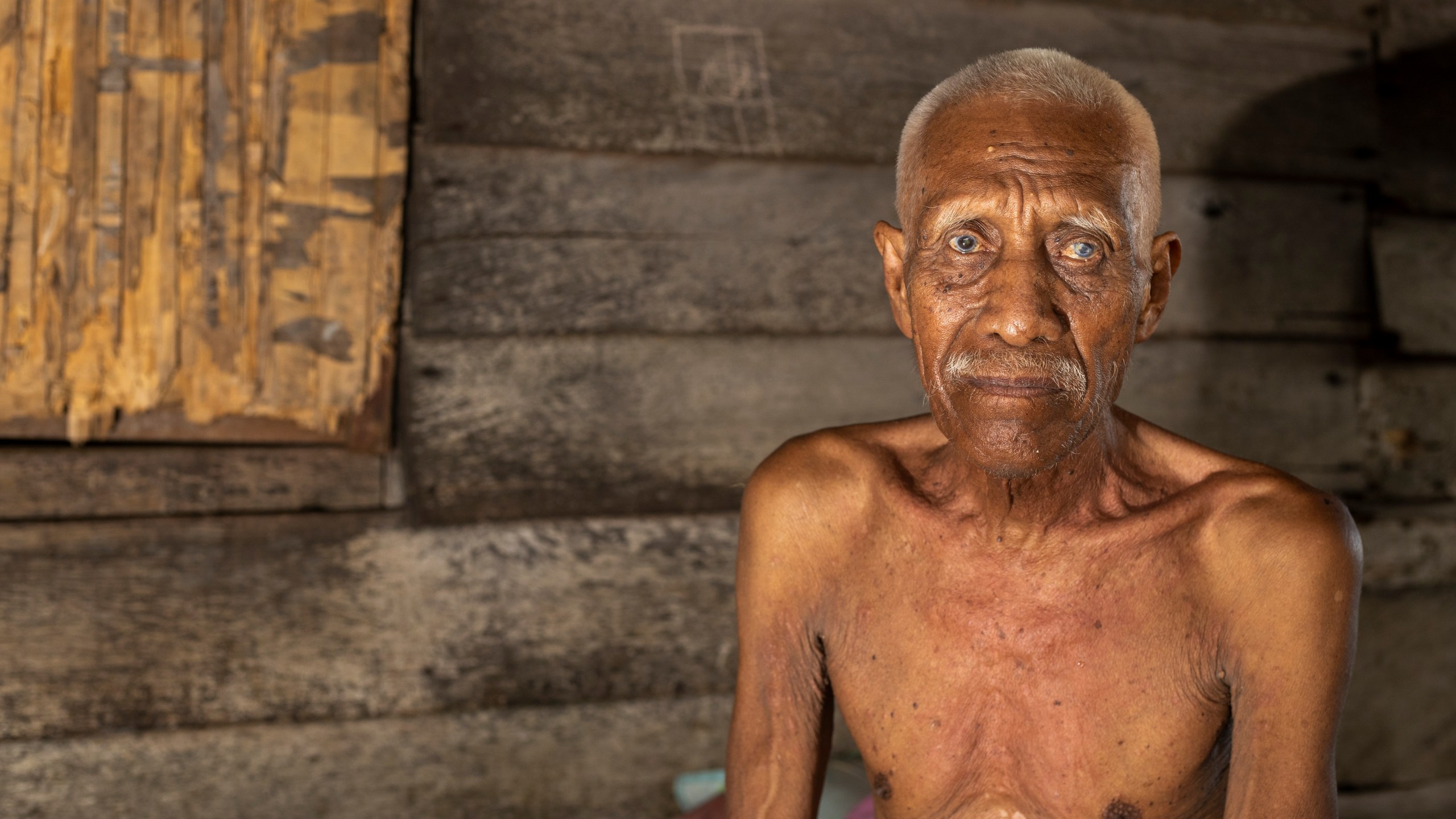 Ilyas, 70, who has been complaining of itchy skin rashes, sits for a photograph at his house on Kabaena Island near nickel mining activities in South Sulawesi, Indonesia, Friday, Nov. 15, 2024. (AP Photo/Yusuf Wahil)