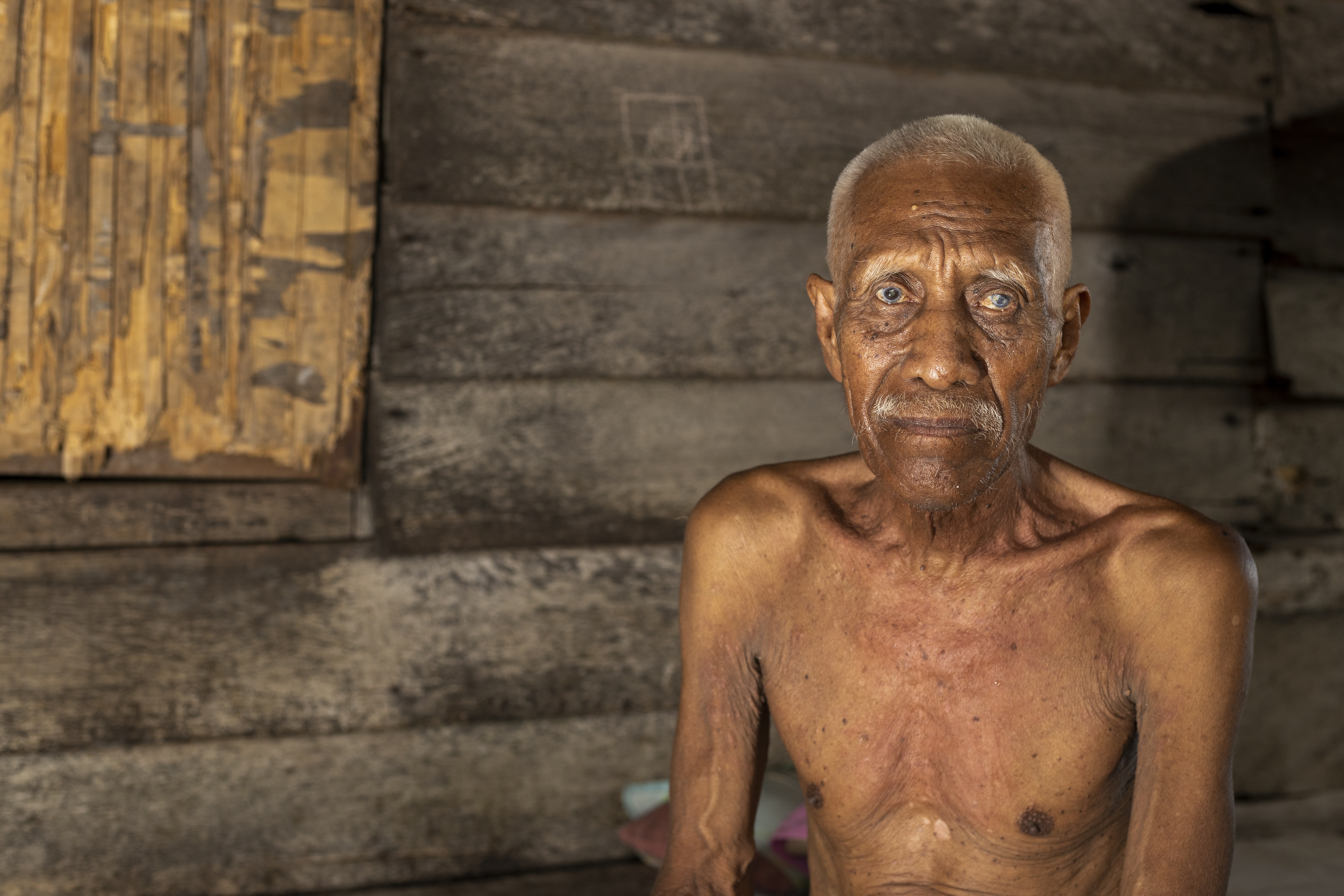 Ilyas, 70, who has been complaining of itchy skin rashes, sits for a photograph at his house on Kabaena Island near nickel mining activities in South Sulawesi, Indonesia, Friday, Nov. 15, 2024. (AP Photo/Yusuf Wahil)