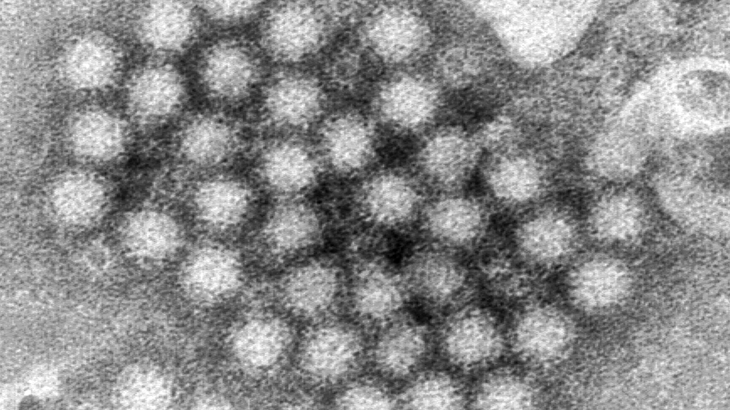 FILE - This electron microscope image provided by the Centers for Disease Control and Prevention shows a cluster of norovirus virions. (Charles D. Humphrey/CDC via AP, File)