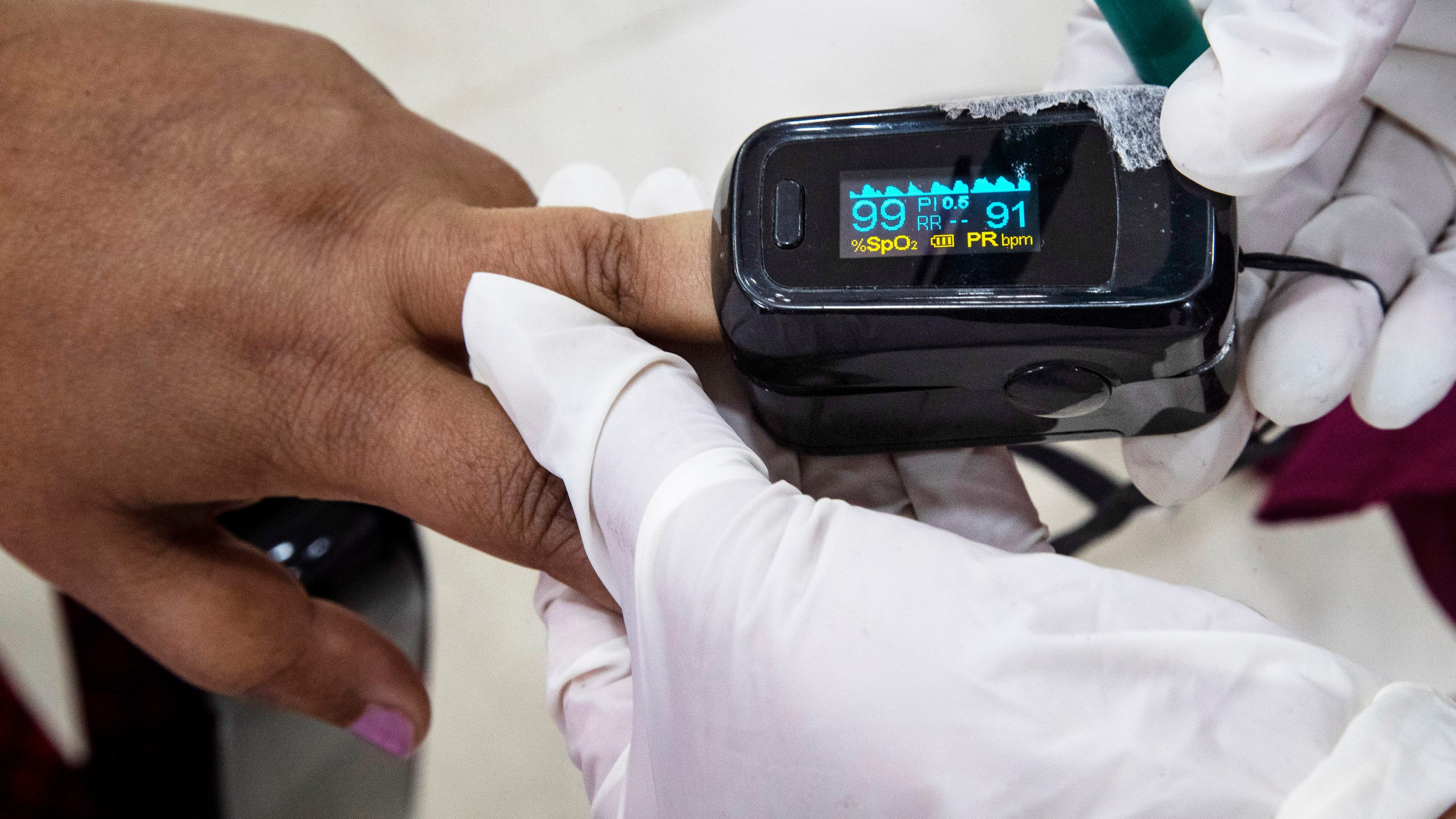 FILE - A health worker uses a pulse oximeter to check the oxygen saturation level of another after administering COVID-19 vaccine at a hospital in Gauhati, India, Jan. 21, 2021. (AP Photo/Anupam Nath, File)