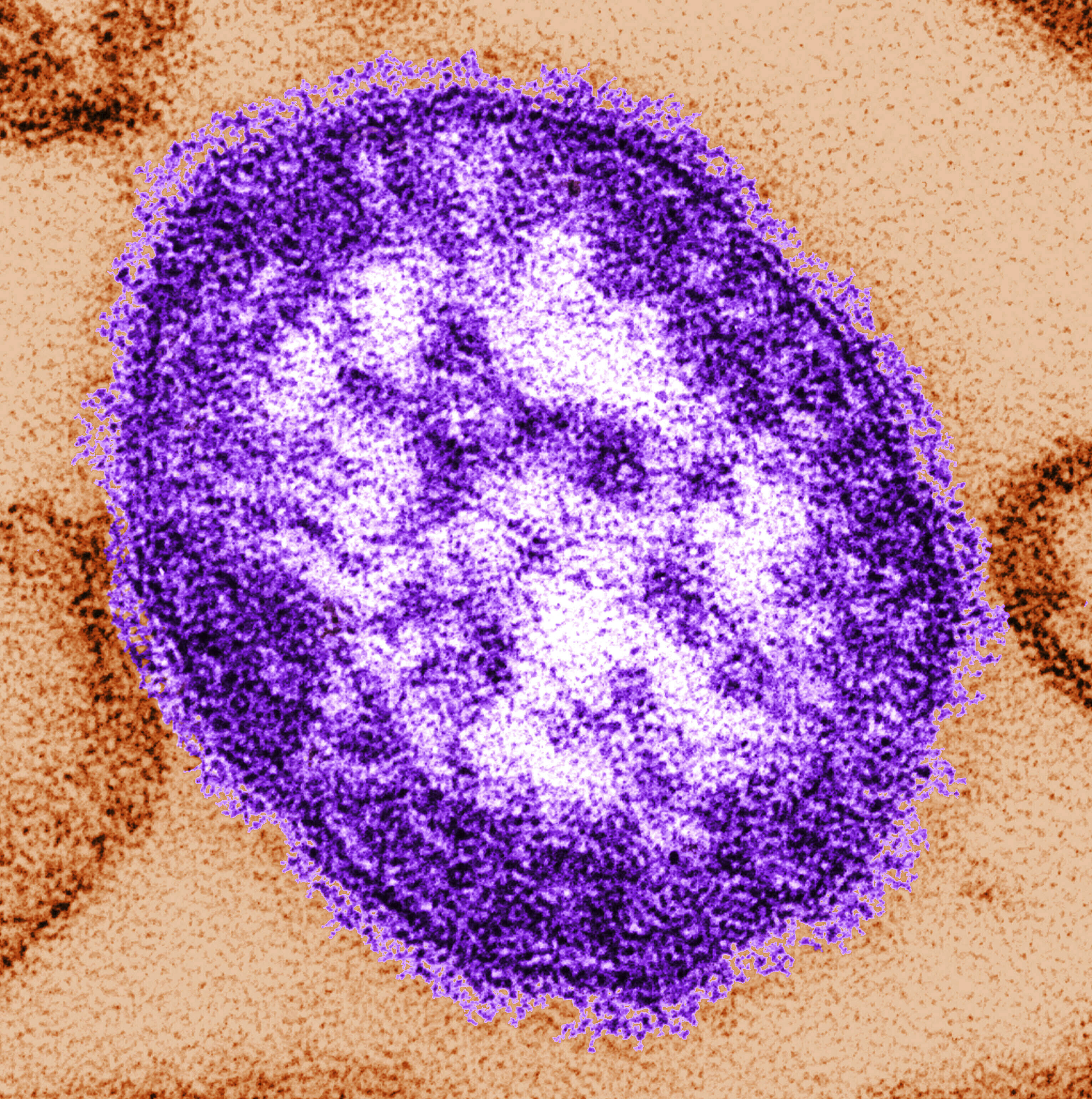 FILE - This undated image made available by the Centers for Disease Control and Prevention on Feb. 4, 2015 shows an electron microscope image of a measles virus particle, center. (Cynthia Goldsmith/Centers for Disease Control and Prevention via AP)